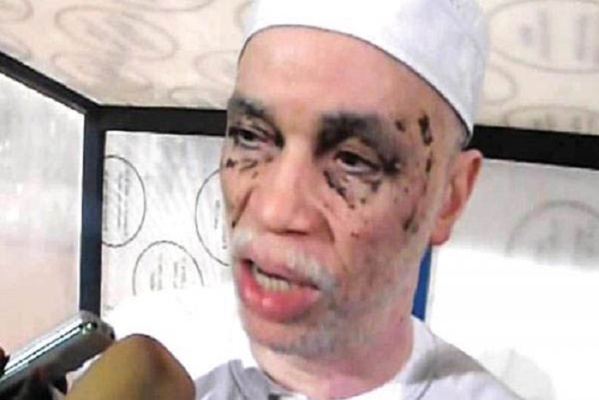 Le message de Mbaye Diouf Dia après sa défaite Le message de Mbaye Diouf Dia après sa défaite