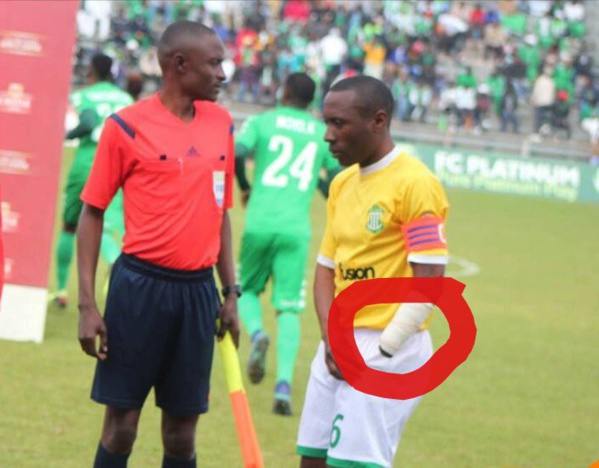 Zimbabwe: amputé d’une main, un joueur revient sur le terrain