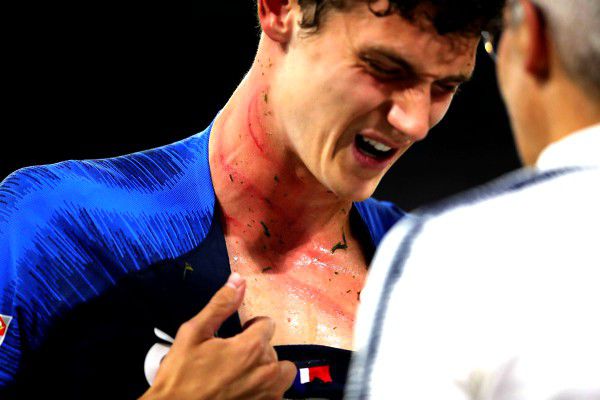 L’impressionnante blessure au cou de Pavard