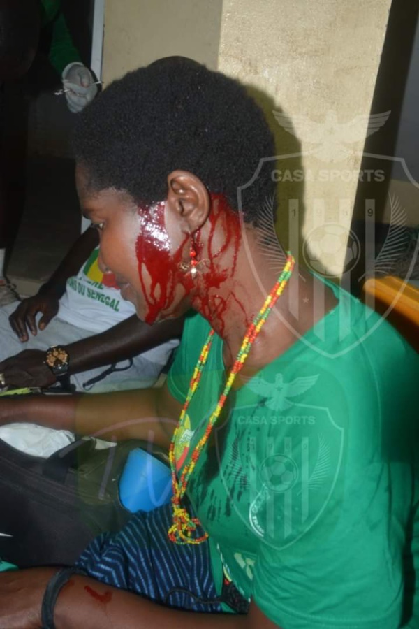 Bataille rangée entre AS Pikine et Casa-Sports : Des blessés et des interpellations notées Bataille rangée entre AS Pikine et Casa-Sports : Des blessés et des interpellations notées