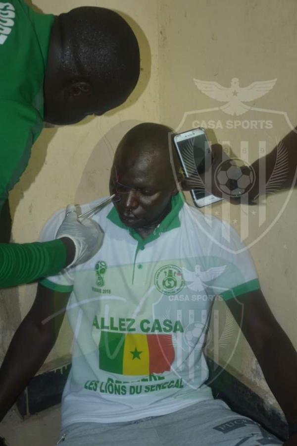 Bataille rangée entre AS Pikine et Casa-Sports : Des blessés et des interpellations notées Bataille rangée entre AS Pikine et Casa-Sports : Des blessés et des interpellations notées