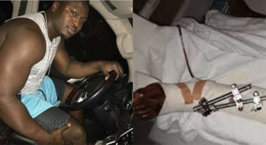 URGENT : Modou Lô blessé, le combat contre Ama Baldé reporté URGENT : Modou Lô blessé, le combat contre Ama Baldé reporté