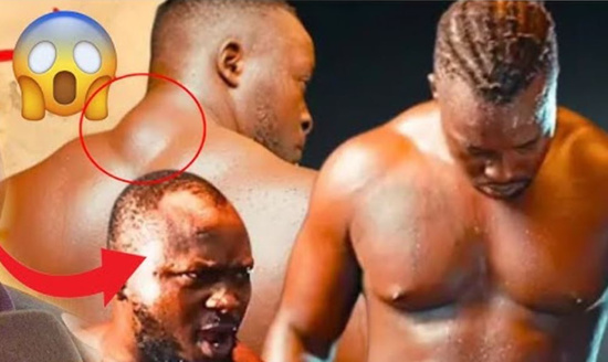 Siteu : Une bosse visible sur le dos du lutteur qui inquiète Siteu : Une bosse visible sur le dos du lutteur qui inquiète