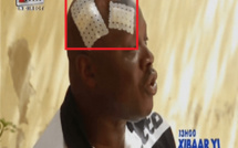 National 2: Amara Traoré attaqué puis blessé par des supporters