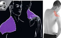 CAN U20 : L'examen de la clavicule pour déterminer l'âge des joeurs